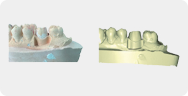 Unsegmented Scanning