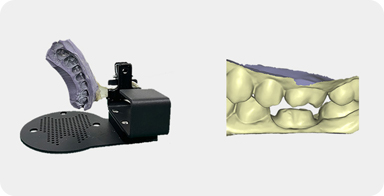 Double-sided Impression Scanning