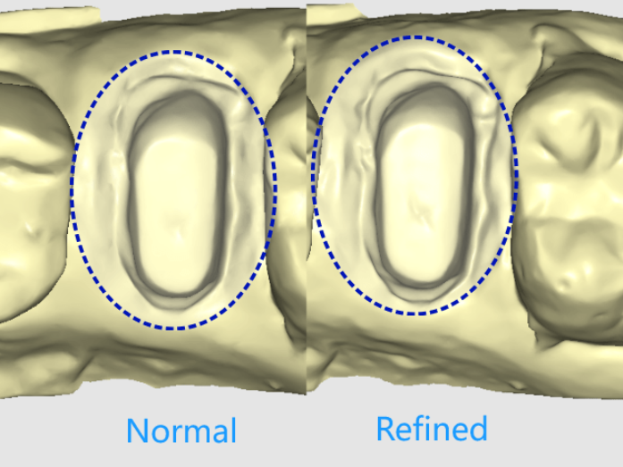 Refined Scan Mode