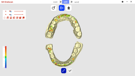 Bite Analysis